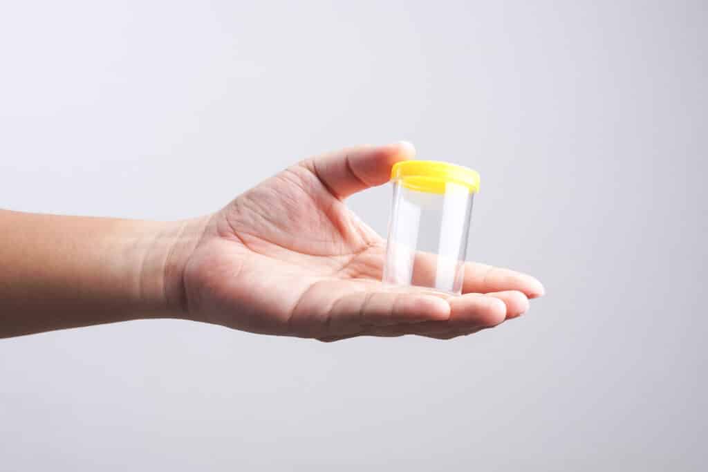 Do Temp Jobs Require Drug Testing?